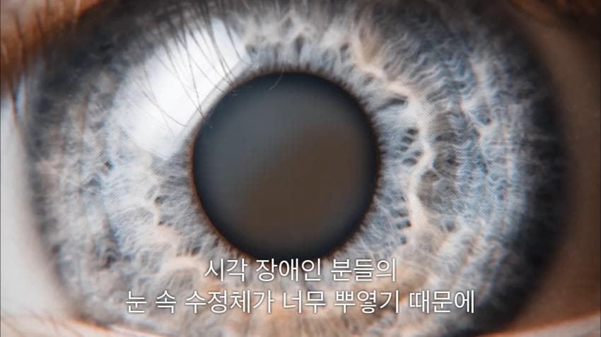 시각장애인 천명 수술시켜 준 미스터 비스트ㄷㄷ