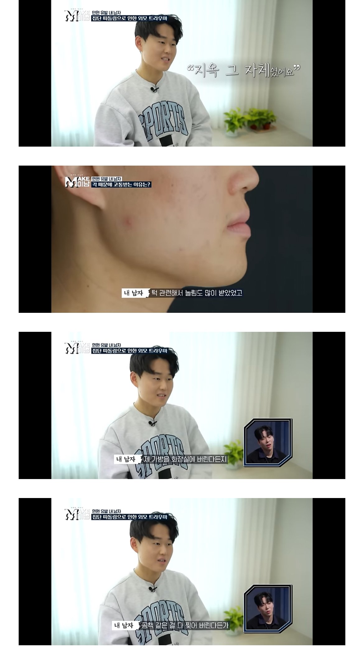 못생겼단 민원받고 성형한 28세 버스기사