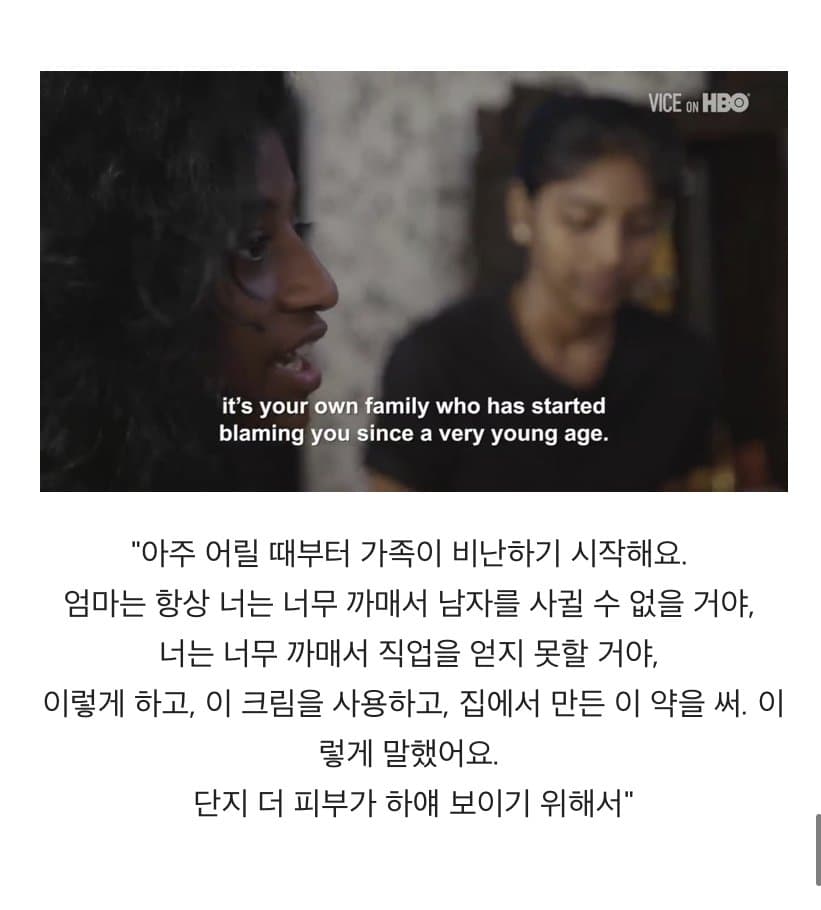 BBC 하얀피부 집착