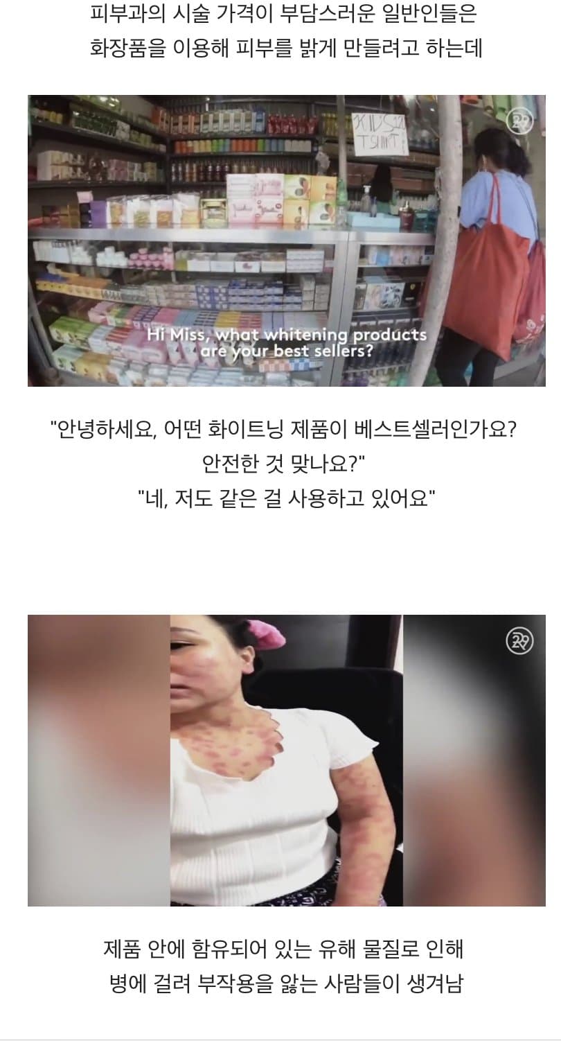 BBC 하얀피부 집착