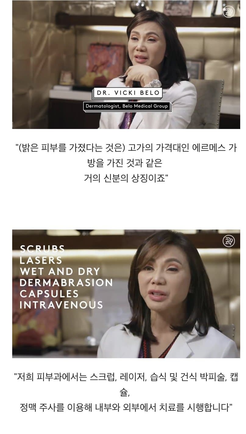 BBC 하얀피부 집착