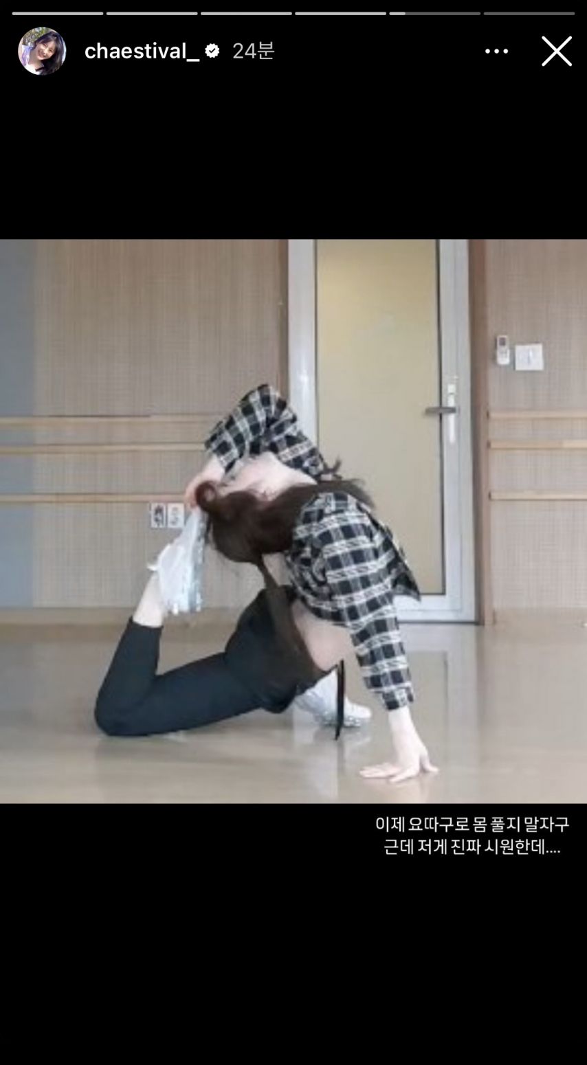 이채연..허리디스크로 당분간 댄스 휴식 [정보글]