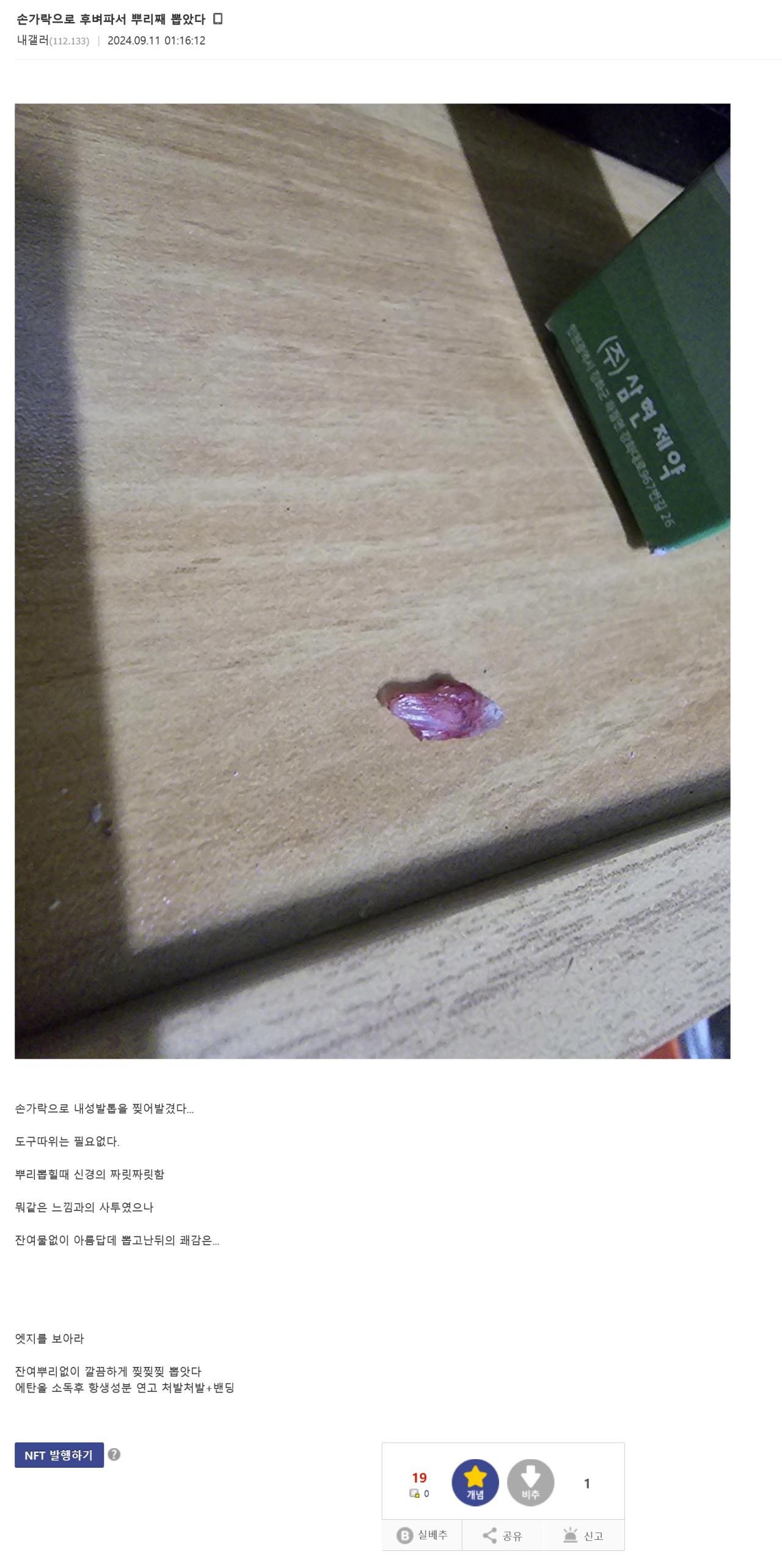 혐)내성발톱 갤러리 레전드