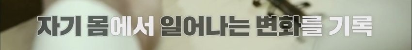 독사에 물렸는데도 치료 거부한 뱀 연구학자