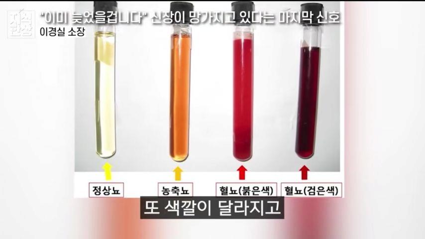 신장이 망가지고 있다는 마지막 신호