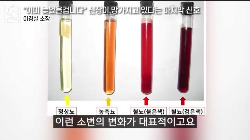 신장이 망가지고 있다는 마지막 신호
