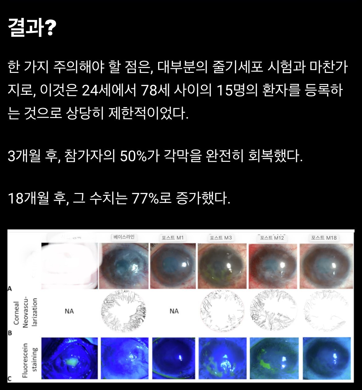 줄기세포로 불가능했던 각막치료 성공 근황 ㅎㄷㄷㄷ