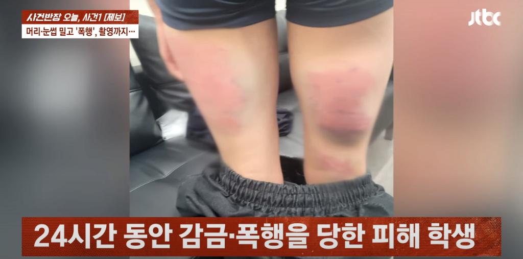 대전에서 발생한 10대 중학생 감금,폭행사건 ㄷㄷ
