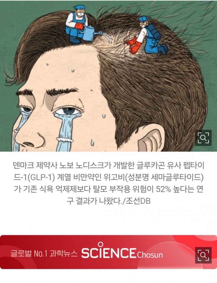 살 빼는데 머리까지… 위고비, 탈모 위험 52% 증가