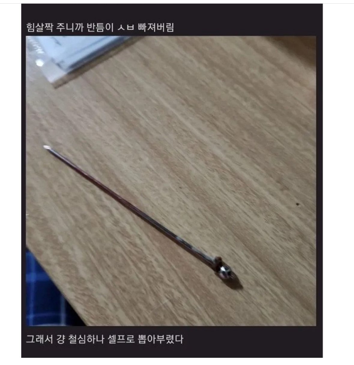 약혐) 집에서 손으로 철심 뺀 사람..