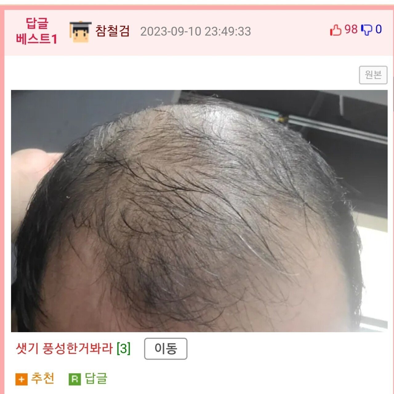 이마 8cm다...자괴감든다...