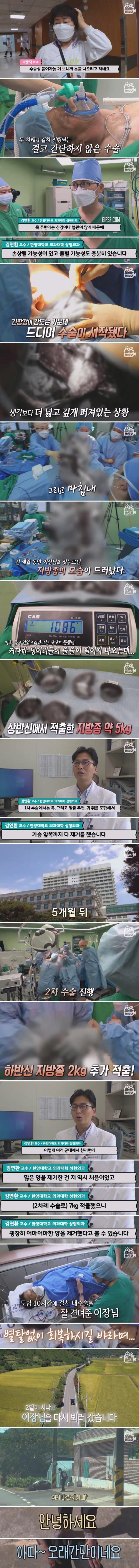 29년 만에 7kg 지방종을 없앤 남자 ㄷㄷㄷ