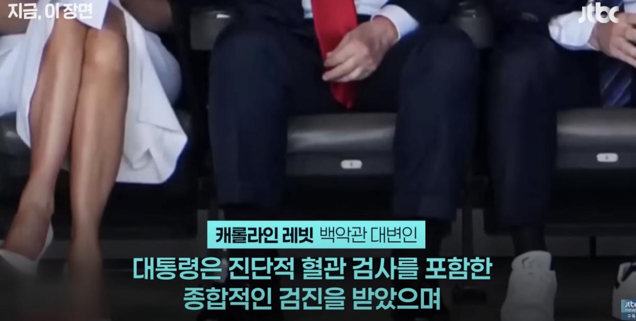 현재, 트럼프 대통령 손 상태