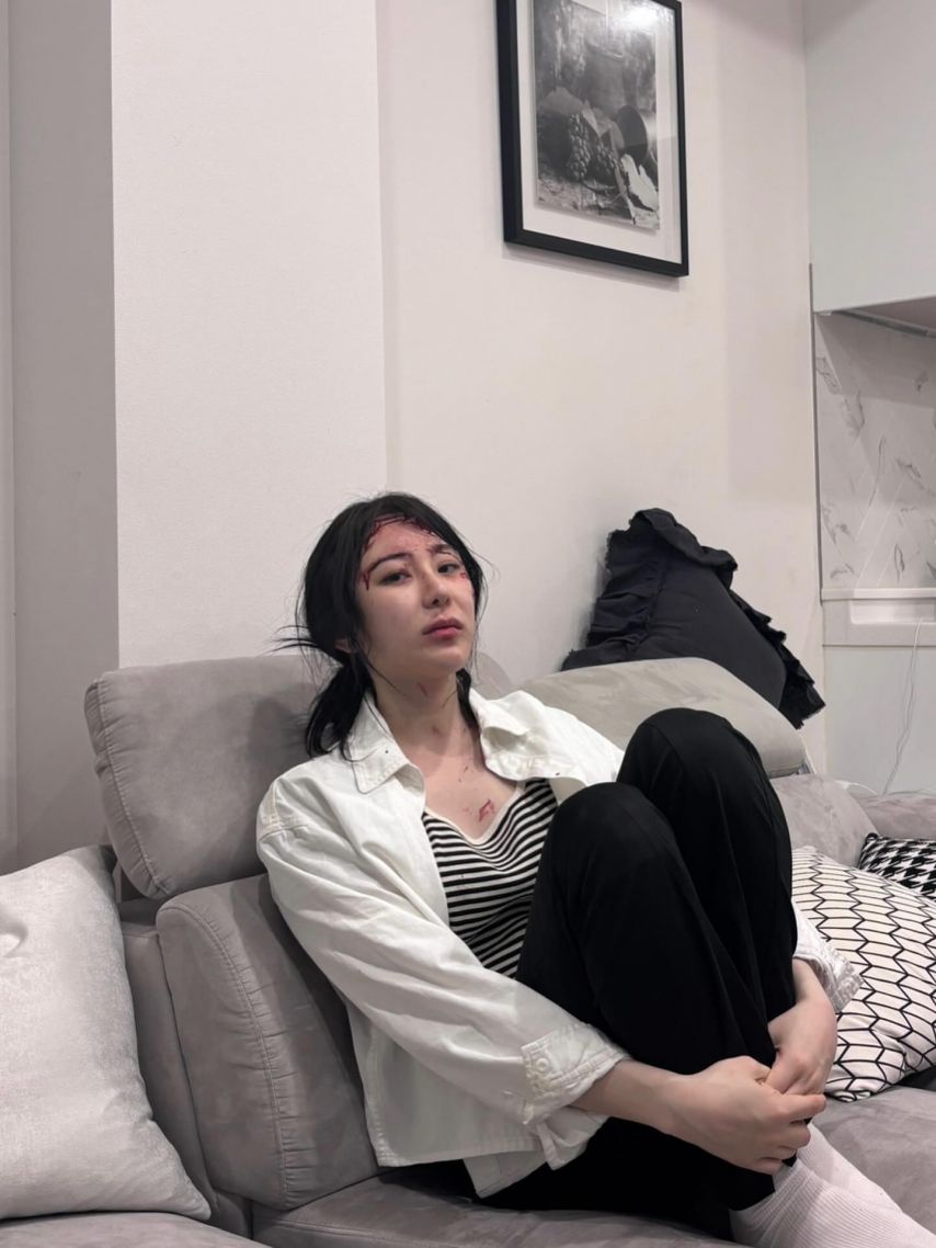 이채연