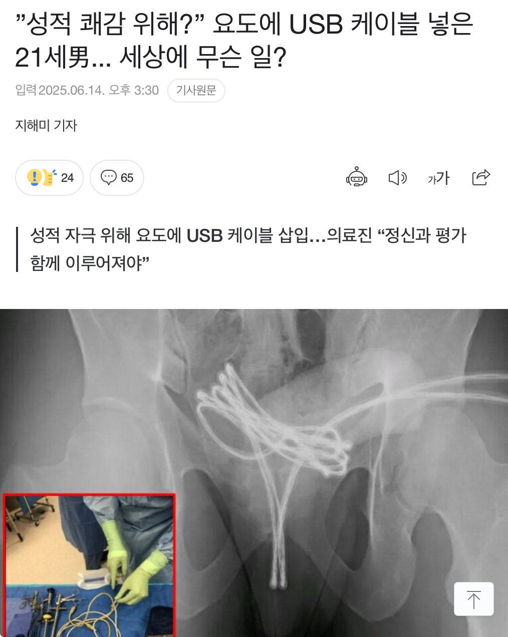 요도에 USB 케이블 넣은 21세 남자