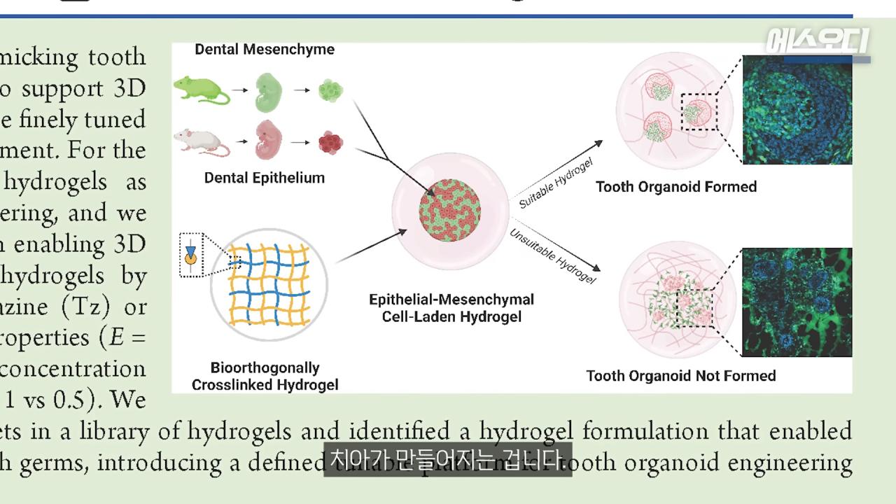 일본의 치아 재생 연구보다 더 주목 받고 있다는 영국 연구