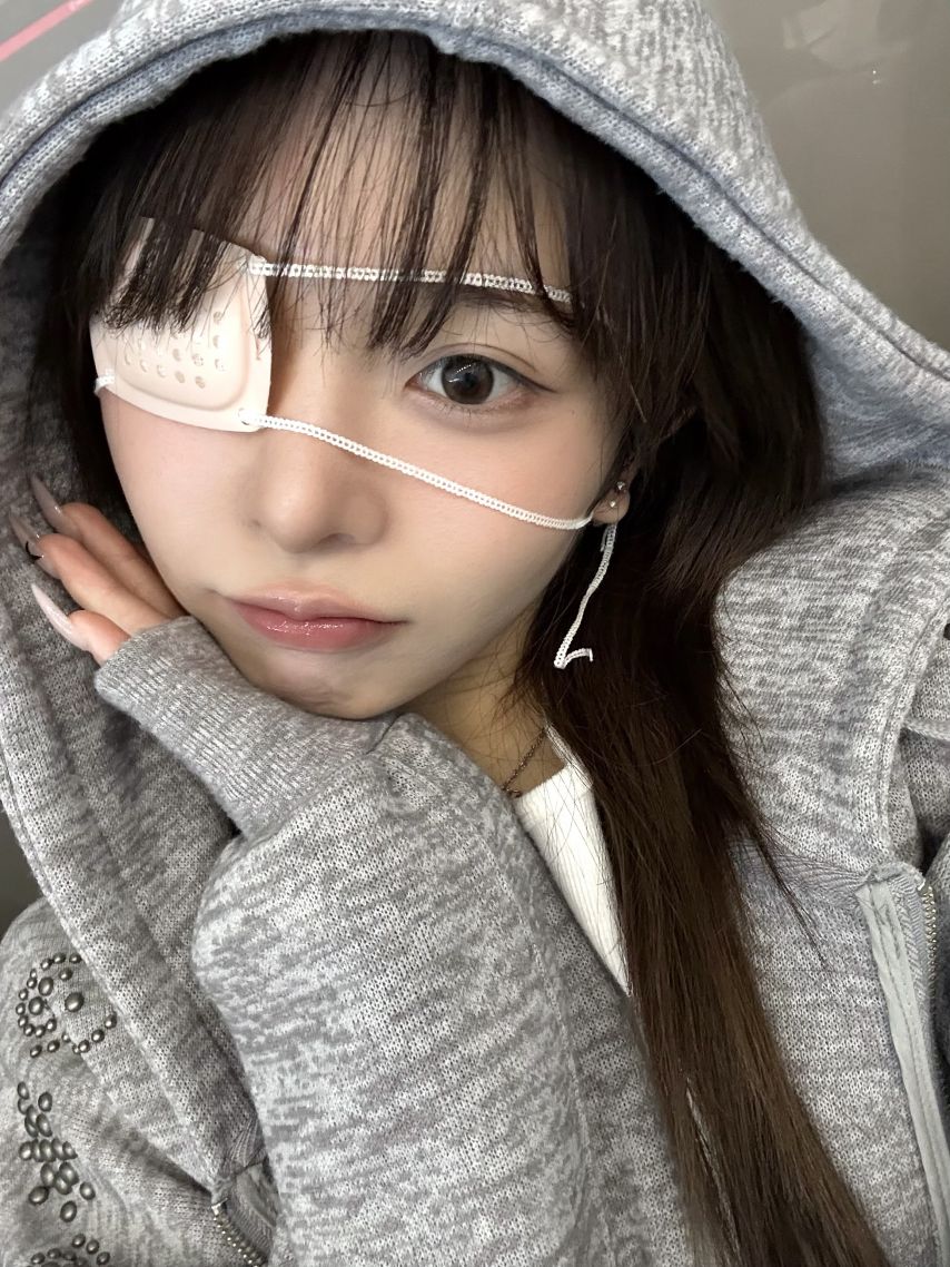 트리플에스 코토네, 수민